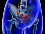 For postmenopausal women undergoing surgical treatment for pelvic organ prolapse