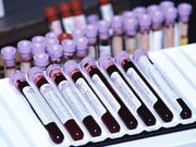 Routine blood tests waste money and can damage patient care