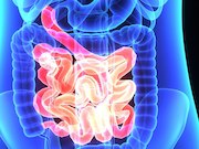 A significant increase in colorectal lesion frequency is seen at 45 years of age
