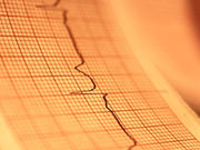 The U.S. Preventive Services Task Force (USPSTF) has found that the current evidence is inadequate to assess the benefits and harms of screening with electrocardiogram for atrial fibrillation in older adults; and for low-risk adults