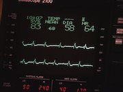 Most intensive care unit patient monitoring alarms are not clinically accurate or relevant