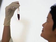 A multi-analyte blood test