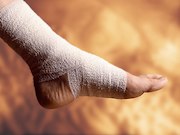There does not appear to be a clinically meaningful association between baseline or prospective hemoglobin A1c and wound healing in patients with diabetic foot ulcers