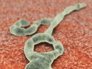 The latest Ebola outbreak in the Democratic Republic of Congo is over