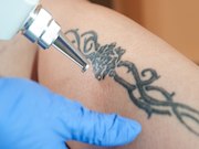 Patients do not appear to mind if doctors have tattoos or piercings