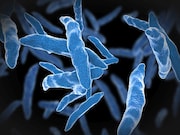 In pretreatment isolates of Mycobacterium tuberculosis