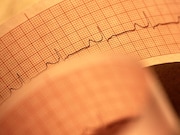 Probands of African or Hispanic/Latino descent with early-onset atrial fibrillation are more likely than European Americans to have a first-degree relative with AF