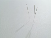 A brief acupuncture intervention is associated with reductions in moderate-to-severe menopausal symptoms
