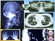 The latest edition of the American College of Radiology Appropriateness Criteria has been released and includes 188 diagnostic imaging and interventional radiology topics