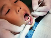 Oral infections in childhood are associated with subclinical carotid atherosclerosis in adulthood
