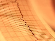 Patient gender and age can be predicted by applying artificial intelligence to an electrocardiogram