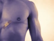 Treatment of male breast cancer has evolved since 2004
