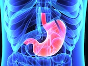 Patients who restart their blood thinners after a gastrointestinal bleed have a lower risk for dying within the next two years even though they have a higher risk for recurrent gastrointestinal bleeding
