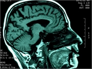 Repetitive mild traumatic brain injuries are associated with elevated exosomal and plasma levels of neurofilament light chain