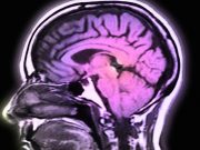 Brain scans may predict which type of therapy will be most effective for obsessive-compulsive disorder in teens and adults
