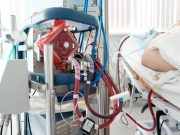 For patients with COVID-19 receiving extracorporeal membrane oxygenation support