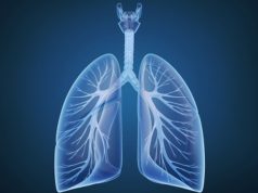 Lung Cancer Tied to Most Potential Years of Life Lost