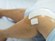 Adverse Events Up With Tourniquet Use in Knee Replacement