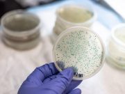 Bacterial culture plate holding in hand