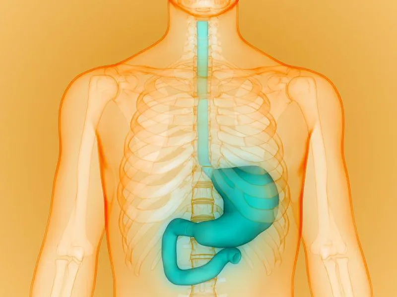 Big Rise in Esophageal Cancers Among Middle-Aged Americans