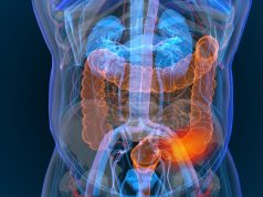 B 5/13 -- Heavy Antibiotic Use Tied to Development of Crohn's