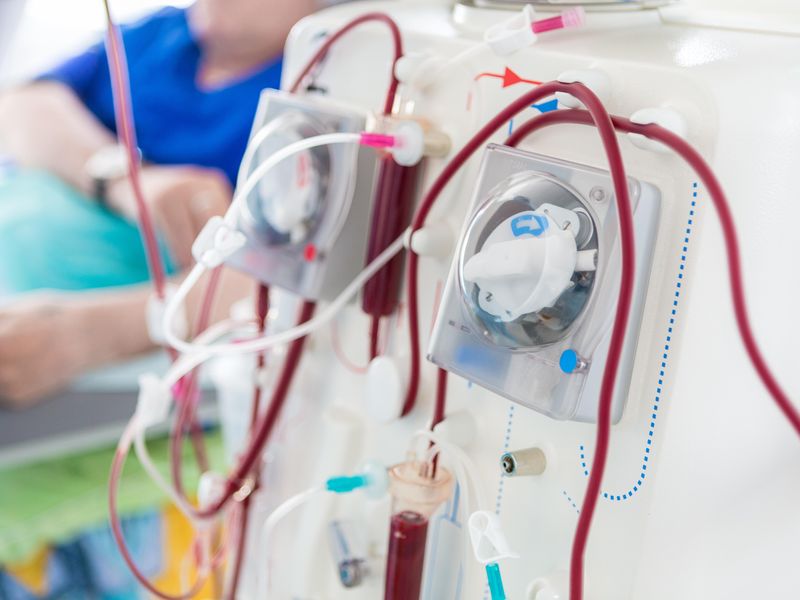 Vaccine Rollout Linked to Drop in Severe COVID-19 in Dialysis Patients