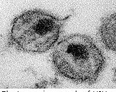 FDA Approves Test to Differentiate HIV Viruses A new diagnostic to differentiate between HIV-1 antibodies