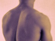 Recalcitrant Back Pain Could Be Vertebral Osteomyelitis Vertebral osteomyelitis should be considered in cases of back or neck pain unresponsive to conservative measures and elevated inflammatory markers with or without fever