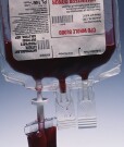 Old Blood As Good As Fresh in Critically Ill Patients Blood that's been stored for a few weeks is just as beneficial as fresh blood for patients with life-threatening conditions who require transfusions