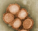 Pregnancy Mortality Due to H1N1 ’09 to ’10 Pandemic: 12 Percent During the 2009 to 2010 pandemic flu season