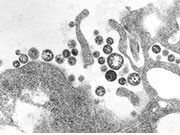 CDC: U.S. Traveler Returning From Liberia Dies of Lassa Fever A man who returned to the United States after traveling to Liberia in West Africa has died of Lassa fever