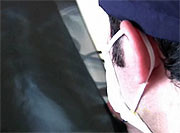 14.9 Million New Cancer Cases Worldwide in 2013 Between 1990 and 2013