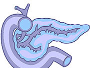 Statin Use Inversely Linked to Pancreatic Cancer Risk Statin use is inversely associated with pancreatic cancer risk