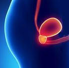 Prolonged ADT Ups Diabetes, CVD Risk for Older Men For men diagnosed with prostate cancer aged older than 70 years