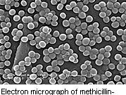 CDC: Action Needed to Better Control Drug-Resistant Infections Almost $8 billion in hospital bills could be avoided over five years by halting the spread of antibiotic-resistant bacteria