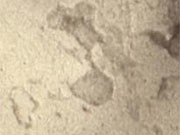 Universal 3rd-Trimester Syphilis Rescreening Not Cost-Effective Universal third-trimester syphilis rescreening is not cost-effective given the national average seroconversion rate