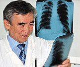 CDC: Decline in TB Rates in the United States Slowing Down As health officials in Kansas struggle with an outbreak of tuberculosis at a local high school