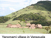 ‘Westernization’ May Drive Disease Via Microbiome In a discovery that could eventually shed light on some diseases that plague modern society