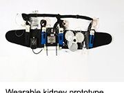 Wearable Artificial Kidney Does Well in Proof-of-Concept Trial A wearable artificial kidney may be an upcoming option for dialysis patients
