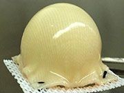 Progress for Lab-Grown Cartilage As Hip Replacement Option Progress has been made toward developing lab-grown cartilage that could postpone or possibly eliminate the need for hip replacement surgery in younger arthritis patients