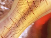 USPSTF: No to ECG Screening to Prevent CVD in Low-Risk Adults The U.S. Preventive Services Task Force recommends against screening with resting or exercise electrocardiography to prevent cardiovascular disease events in low-risk asymptomatic adults. This final recommendation statement has been published in the June 12 issue of the <i>Journal of the American Medical Association</i>.