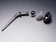 Hip Implant Survival Tied to Implant Choice Between-hospital variation in survival rates of total hip replacement may be due to implant choice
