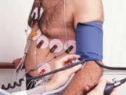 Routine Preop Stress Testing Down in Hip, Knee Arthroplasty From 2006 to 2017