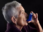 Corticosteroid Exposure Affects Bone Health in Asthma Patients For patients with asthma