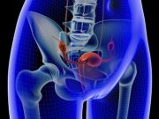 Rate of Injuries Increased Around Diagnosis of Cervical Cancer Women with invasive cervical cancer have an increased rate of iatrogenic and noniatrogenic injuries during diagnostic workup