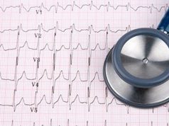 AHA: Care for Type 2 Myocardial Infarction Patients Varies