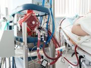 Early ECMO-Facilitated Resuscitation Ups Survival in OHCA