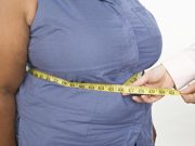Obesity Increases Hip Fracture Risk Before Age 70 in Postmenopausal Women Obesity Impacts Breast Cancer Survival