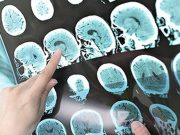 Radiological Society of North America, Nov. 29-Dec. 5