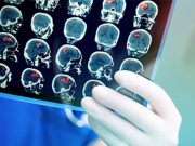 Out-of-Pocket Costs Rising for Neurology Tests, Visits More Brain Issues Among COVID Patients Cited
